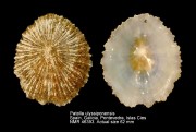Patella ulyssiponensis